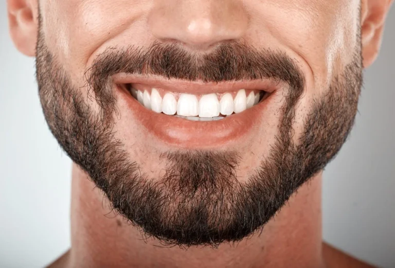 Facetas em Cerâmica